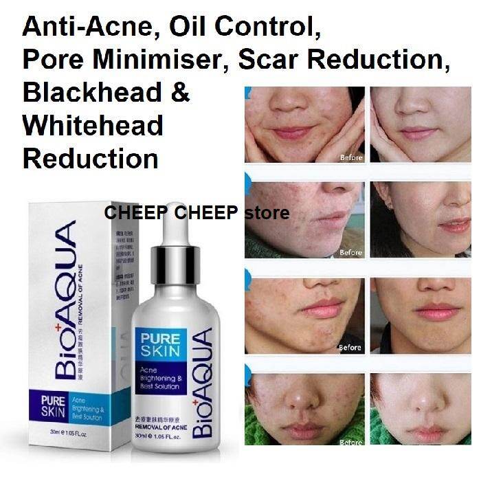 bioaqua pure skin anti acne