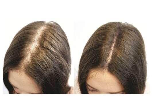 biotin-before-and-after.jpg