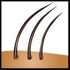 img-thinning area.jpg