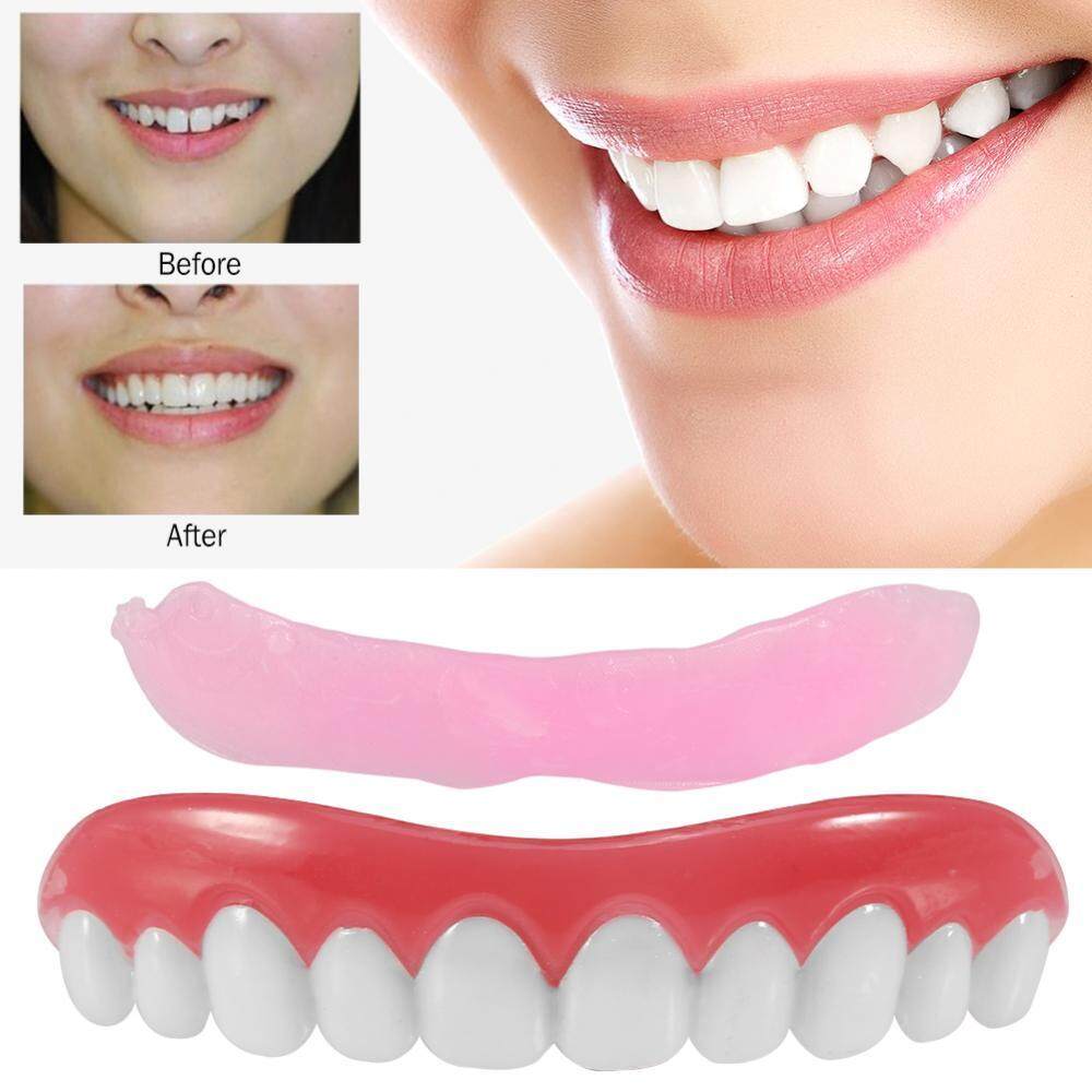 Perfect Smile Veneers в Магнитогорске