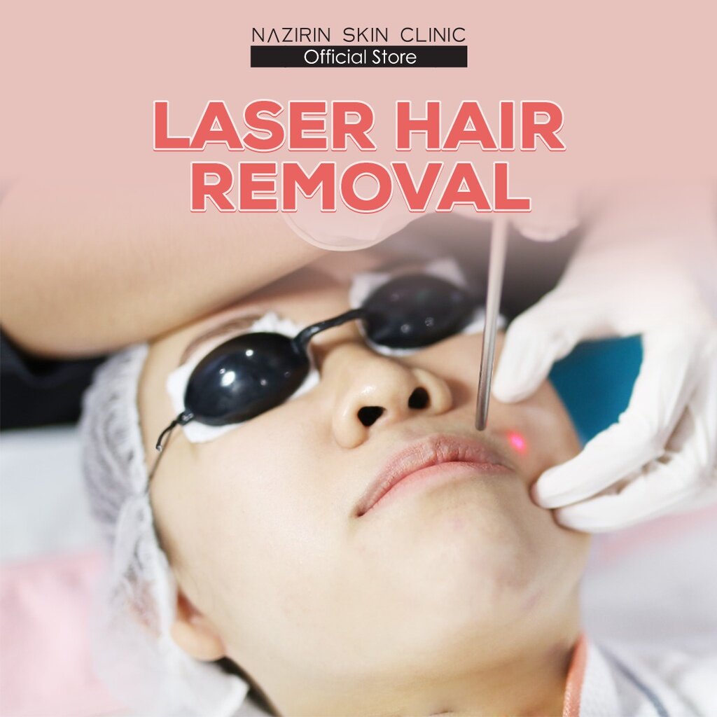 [NSC][50% off] Unlimited Claimed Session Laser Hair Removal