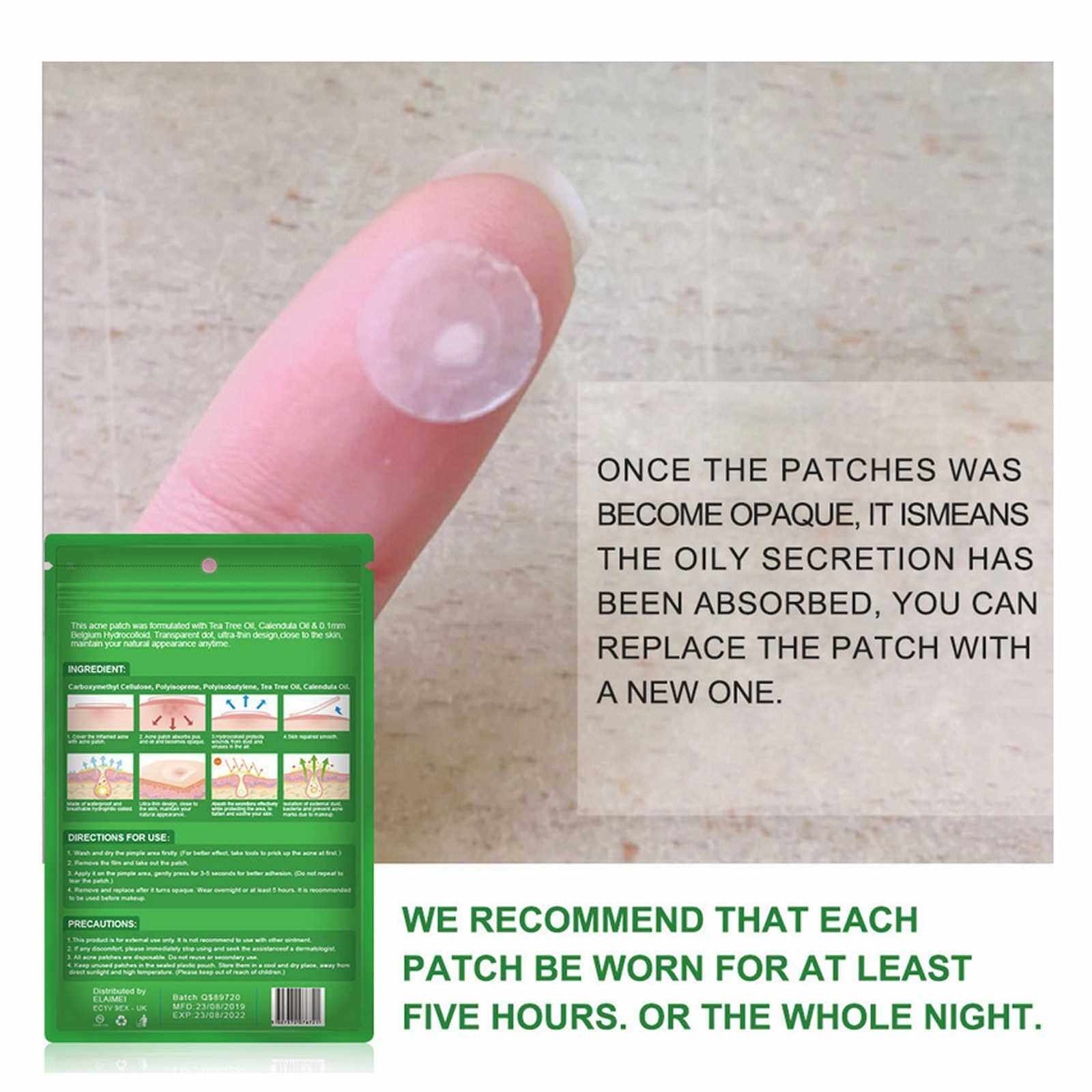 BEST SELLER 24 Patches Acne Pimple Patch Invisible Acne Removal Stickers Pimple Remover Tool Face Skin Care for Day Night Use (Green)