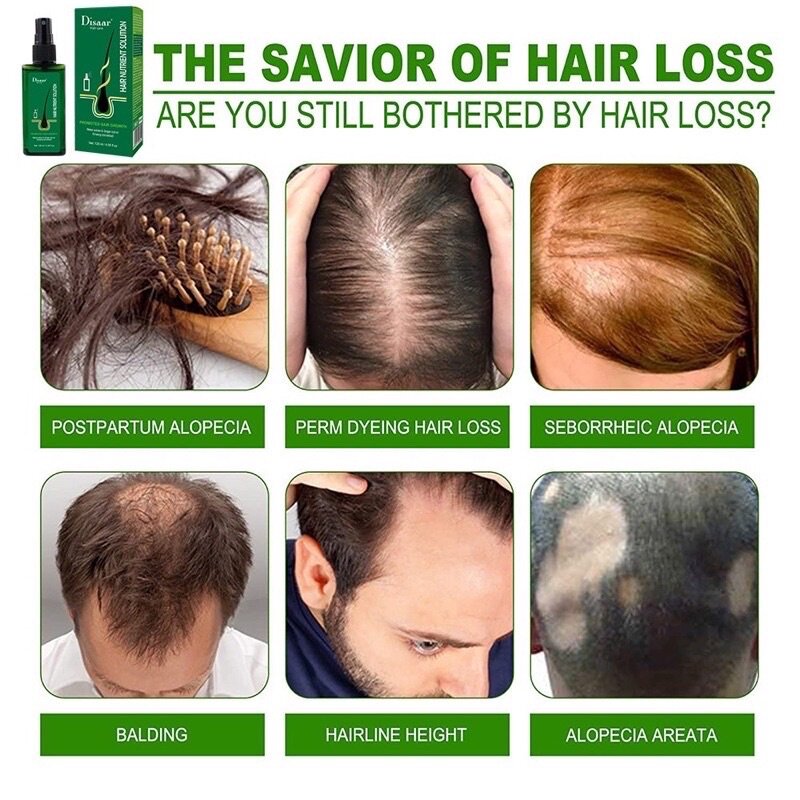 Neo Hairlotion Hair Root Nutrients LoveOriginal Jojo Disar Hair Oil [ Cheapest Wholesale Deals ]