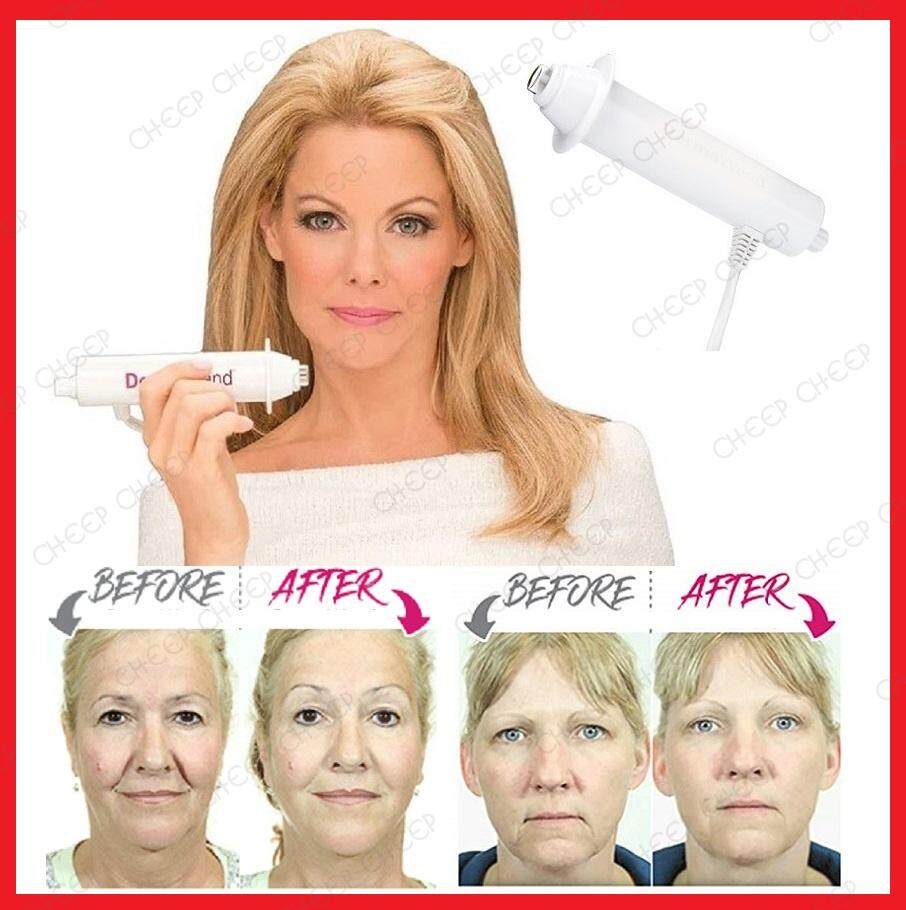 Derma Young Pro Microcurrent + RF Radio Frequency Powerful Anti-Aging Wrinkle Pore Sagging Puffy Eyes Wand Massager