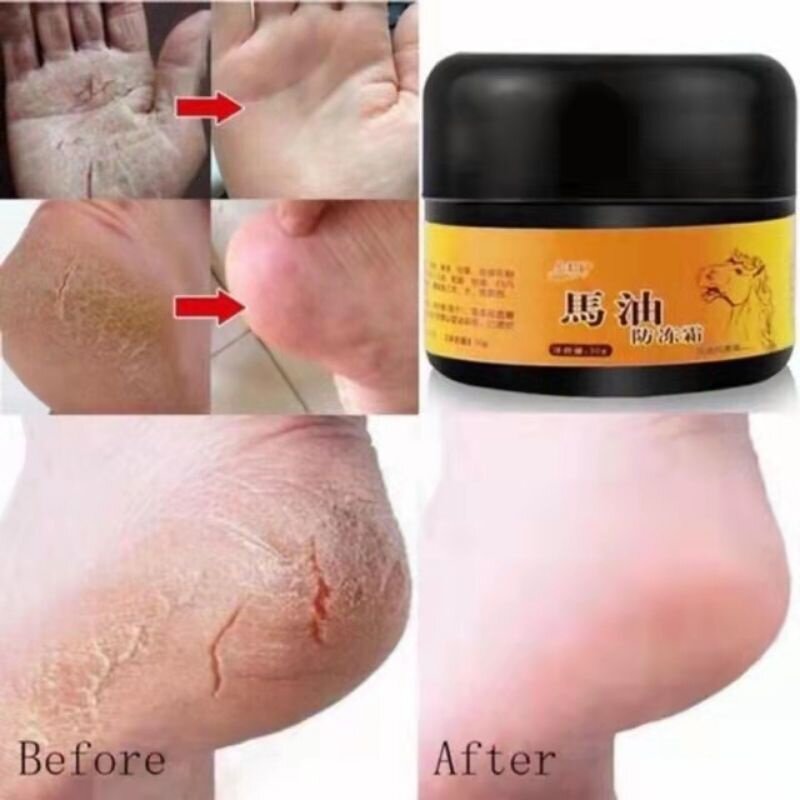 Horse Oil Feet and Heel Repairing Moisturizer Cream Foot Cream