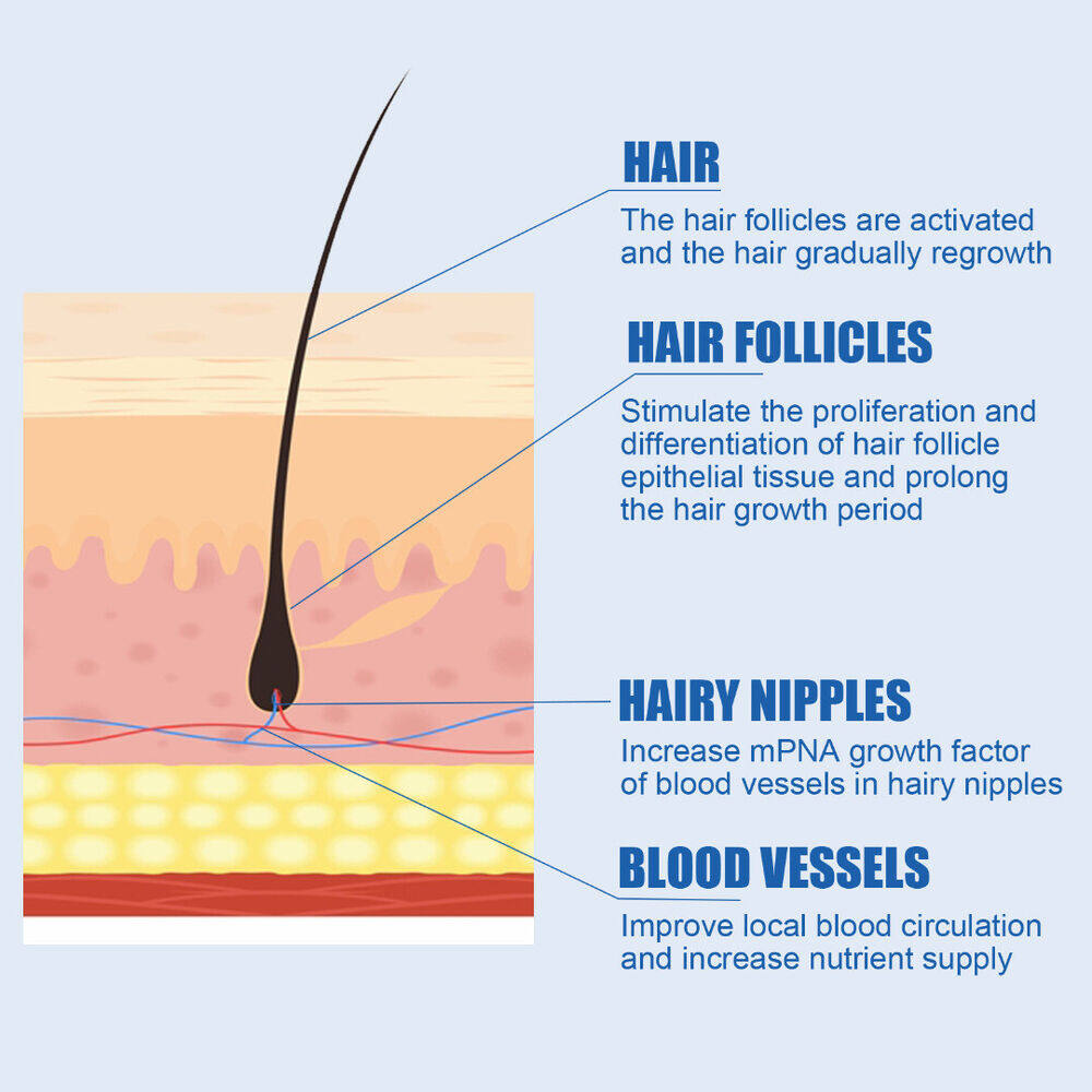 Minoxidil 5% thêm độ chắc lỏng để xử lý Dung dịch mọc lại tóc Râu nam