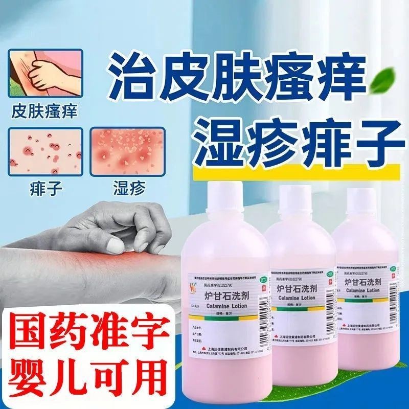 本土炉甘石洗剂100ml(儿童可用）皮肤病皮炎湿疹痱子热痱止痒荨麻疹外用药
