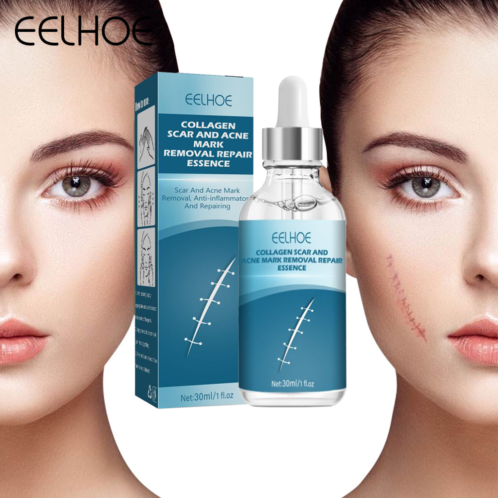Eelhoe tinh chất phục hồi vết sẹo mụn collagen dung dịch phục hồi vết sẹo phẫu thuật loại bỏ mụn trứng cá vết rạn da tinh chất phục hồi vết sẹo mổ lấy thai vết bỏng mịn 30ml