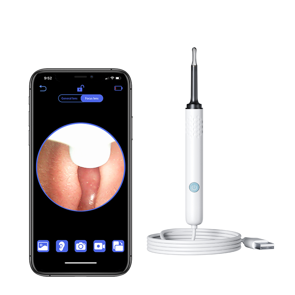Thông Minh Hình Ảnh dụng cụ lấy ráy tai dụng cụ vệ sinh tai Có Dây Phát Sáng Nội Soi Hd Soi Tai ráy tai Chọn Muỗng Cho IOS Android