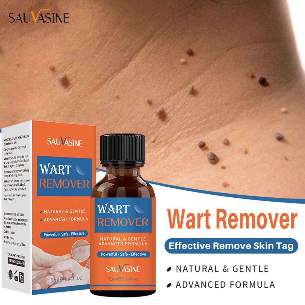 Sauvasine serum loại bỏ mụn cóc loại bỏ thẻ da cơ thể loại bỏ mụn cóc kháng khuẩn rất hiệu quả