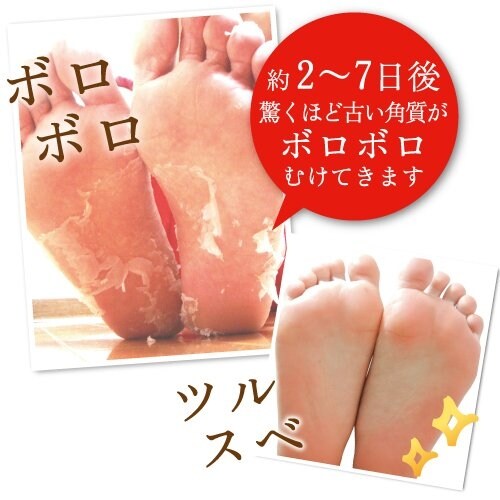 Baby Foot Babyfoot Peeling Foot Skin Mask - Peach Limited Edition - Size M for female user - Original from Japan (READY STOCK)