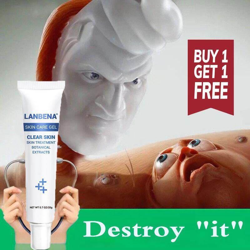 Cream Whitening Moisturizing Remove Melasma Acne Spots Pigment Melanin Dark Spots Face Care Cream