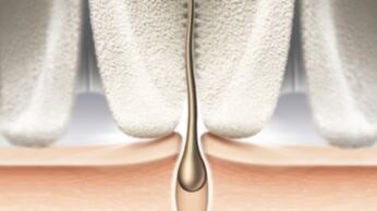 Epilation head of unique ceramic material for better grip