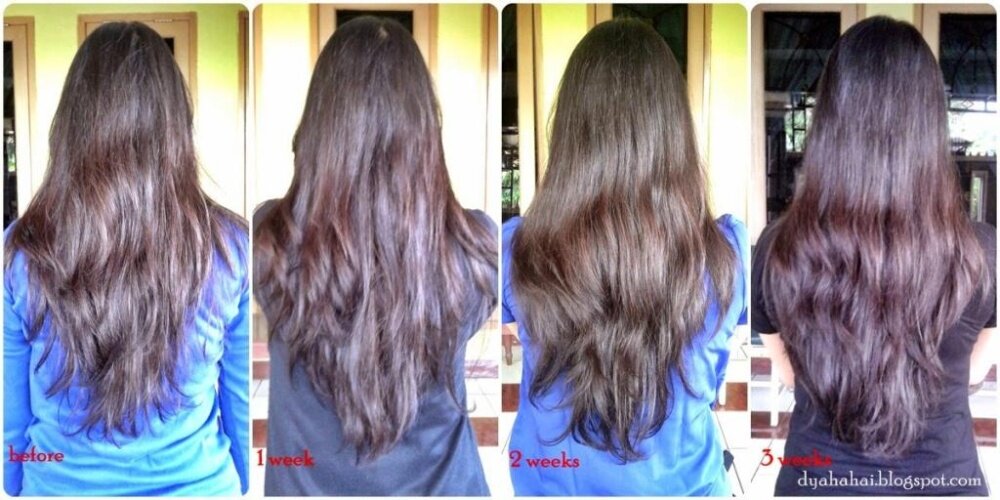 Mane N Tail Usa No 1 Hair Growth Anti Loss Original Shampoo Brand Mane N Tail