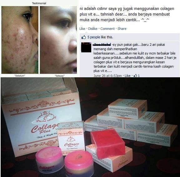 2 x collagen plus vit e whitening soap lazada 2 x collagen plus vit e whitening soap lazada